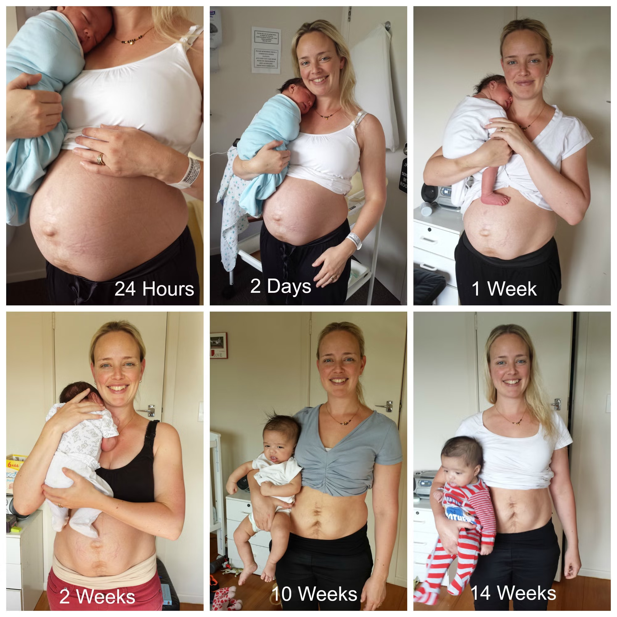 Postpartum body progression 24 hours to 14 weeks